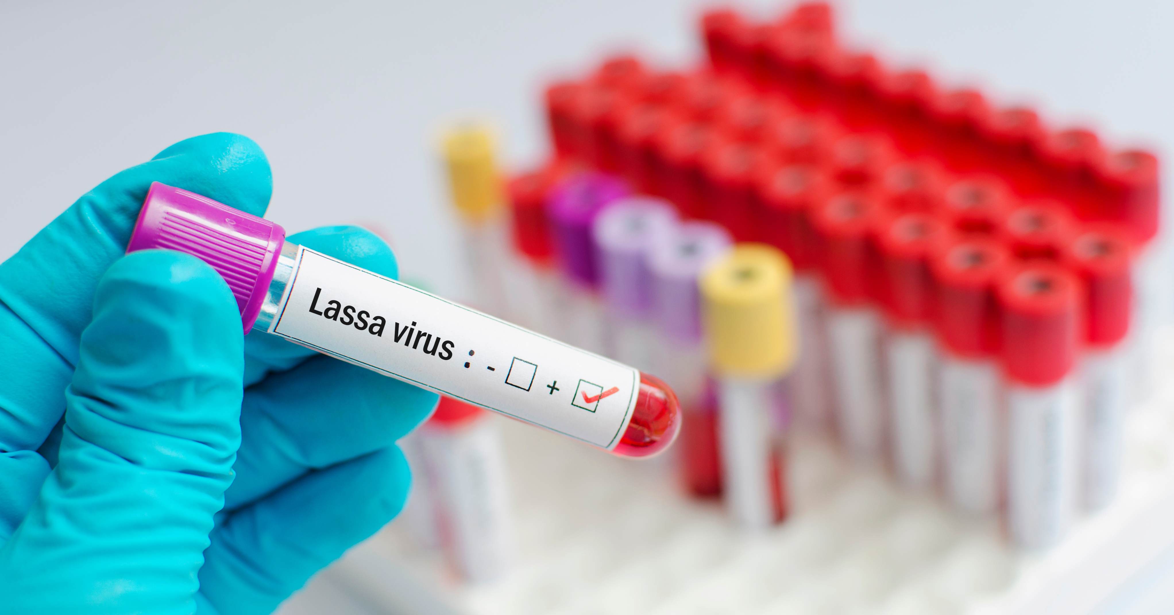 Virus Lassa
