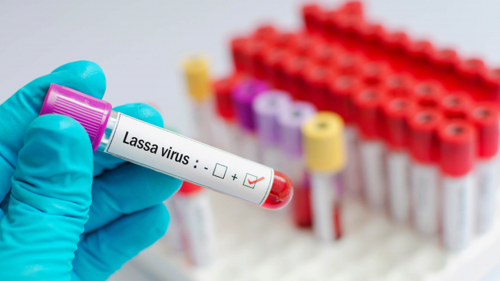 Virus Lassa
