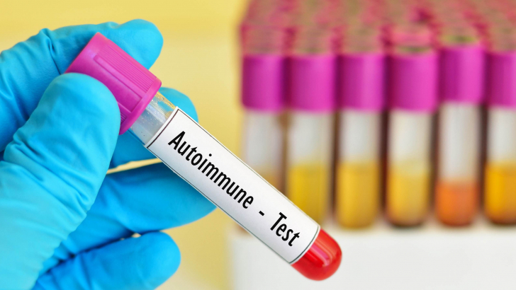 Test per malattie autoimmuni