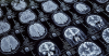 brain