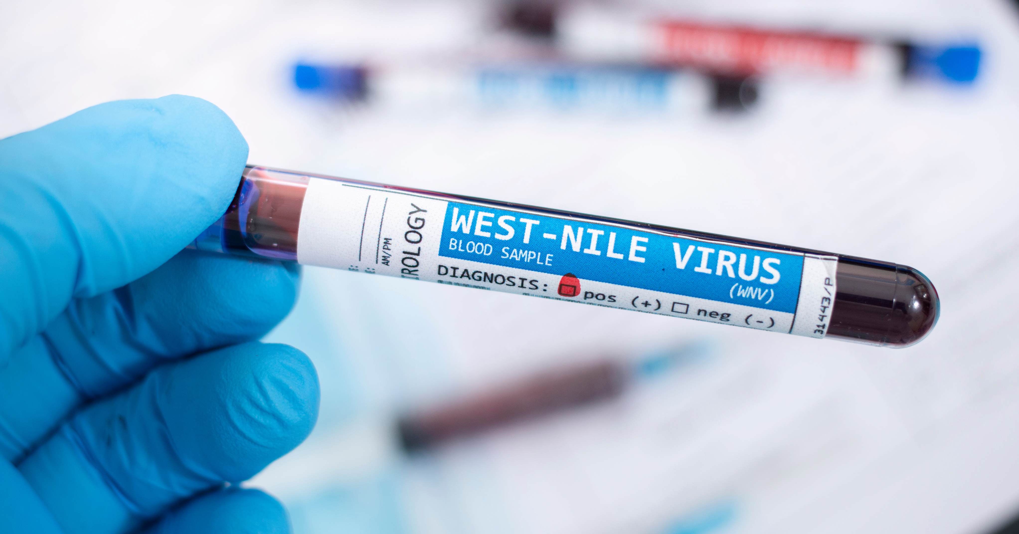 Test West Nile virus