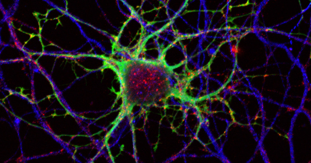 neurone cervello