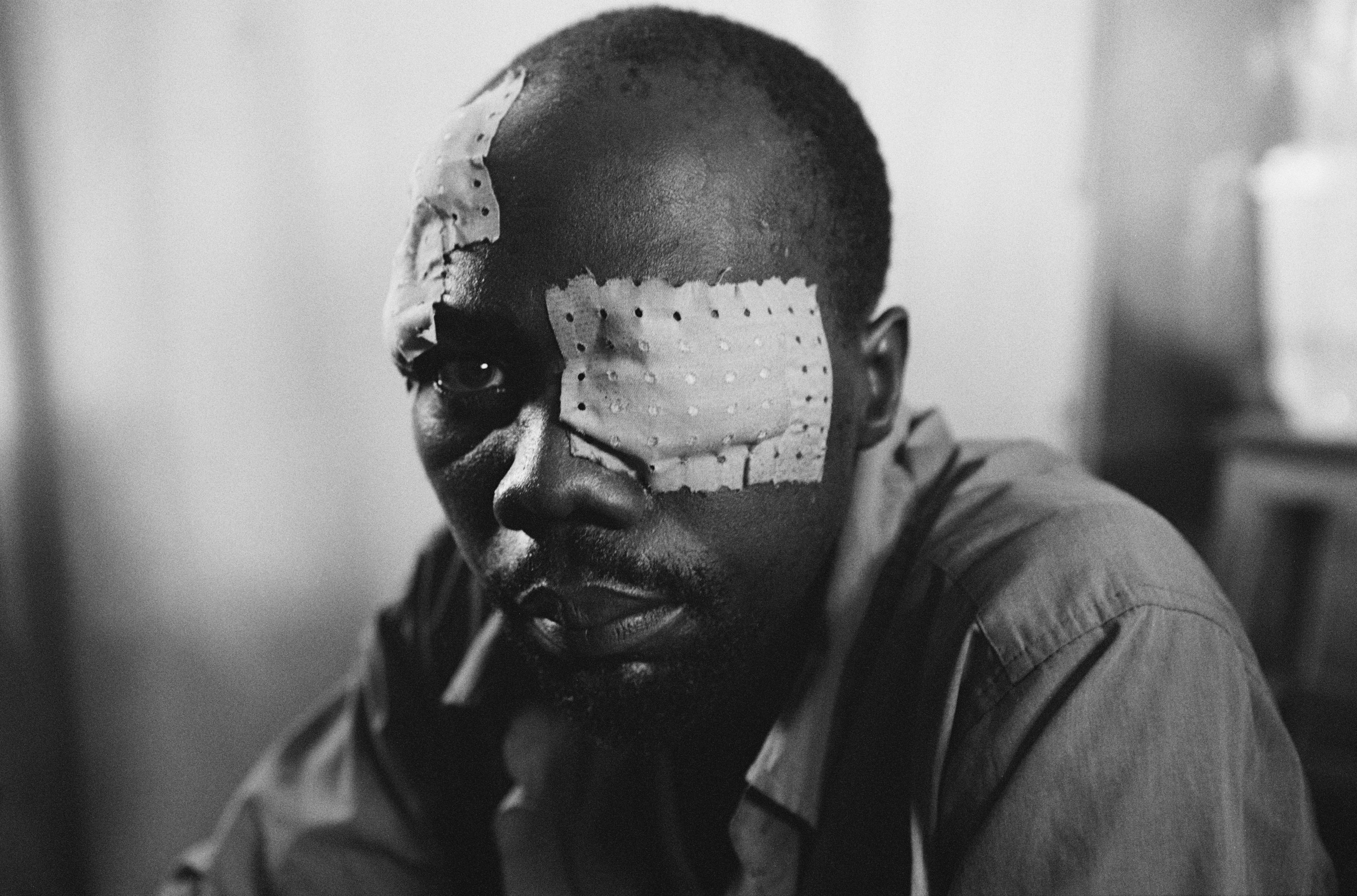 Foto Giles Duley