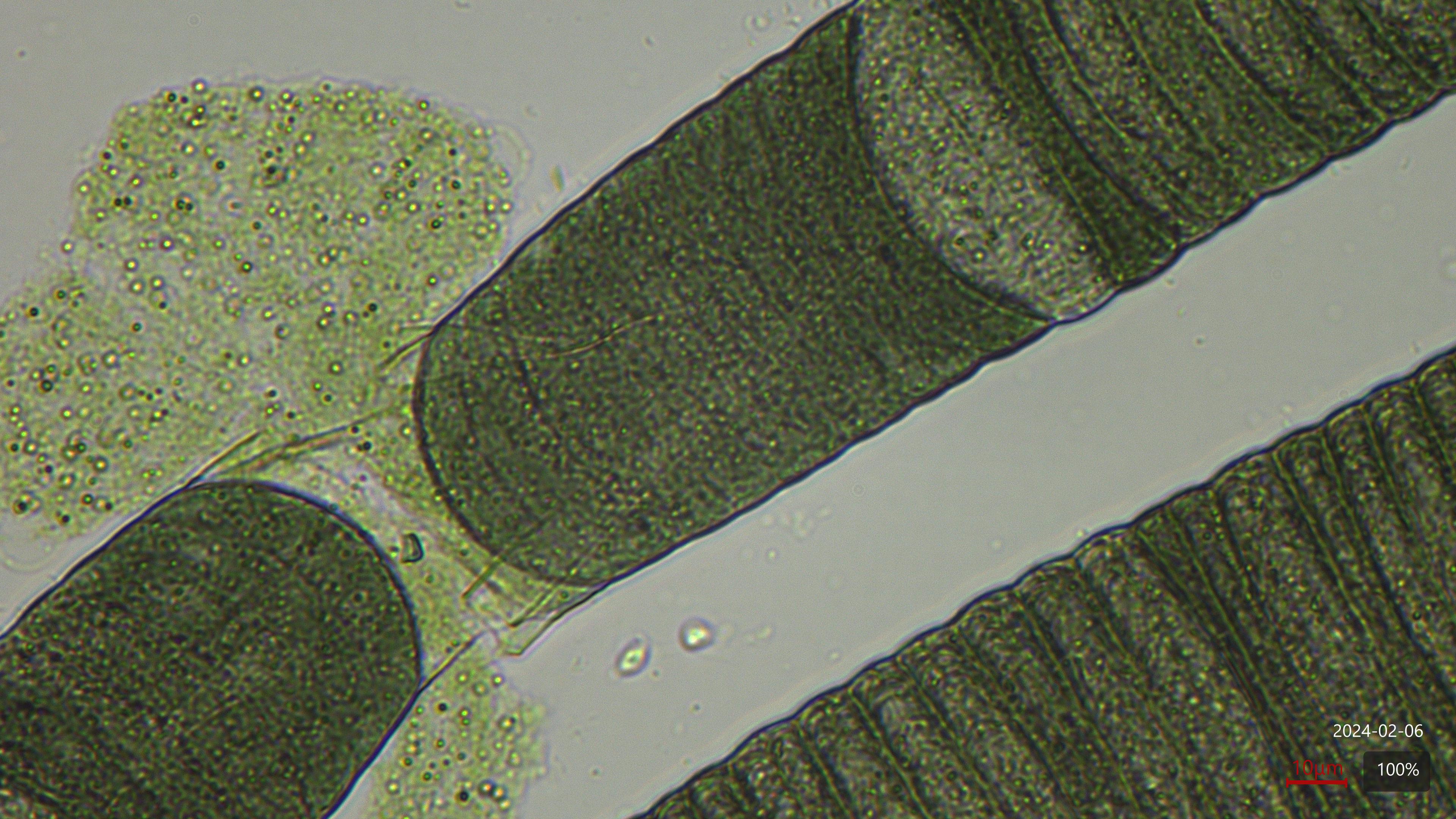 ceppi cianobatteri
