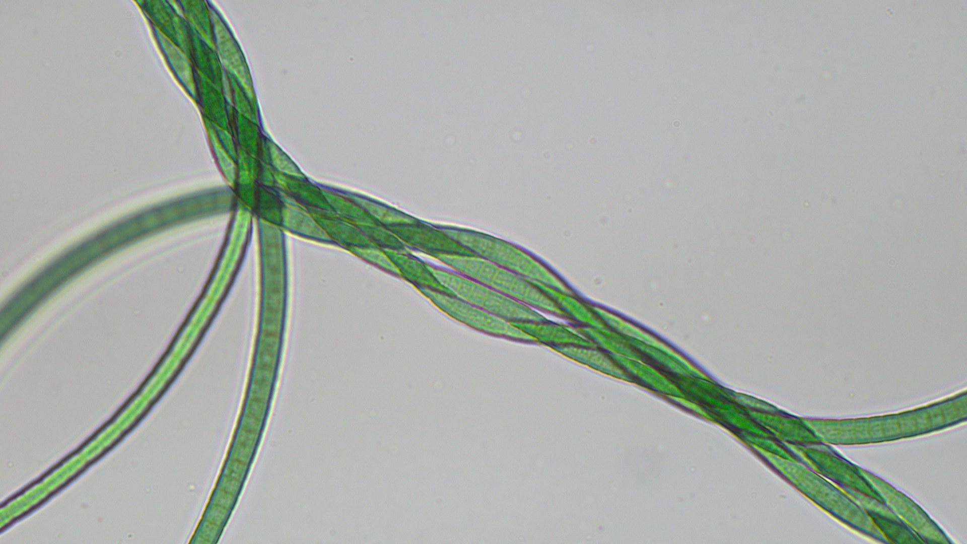 ceppi cianobatteri