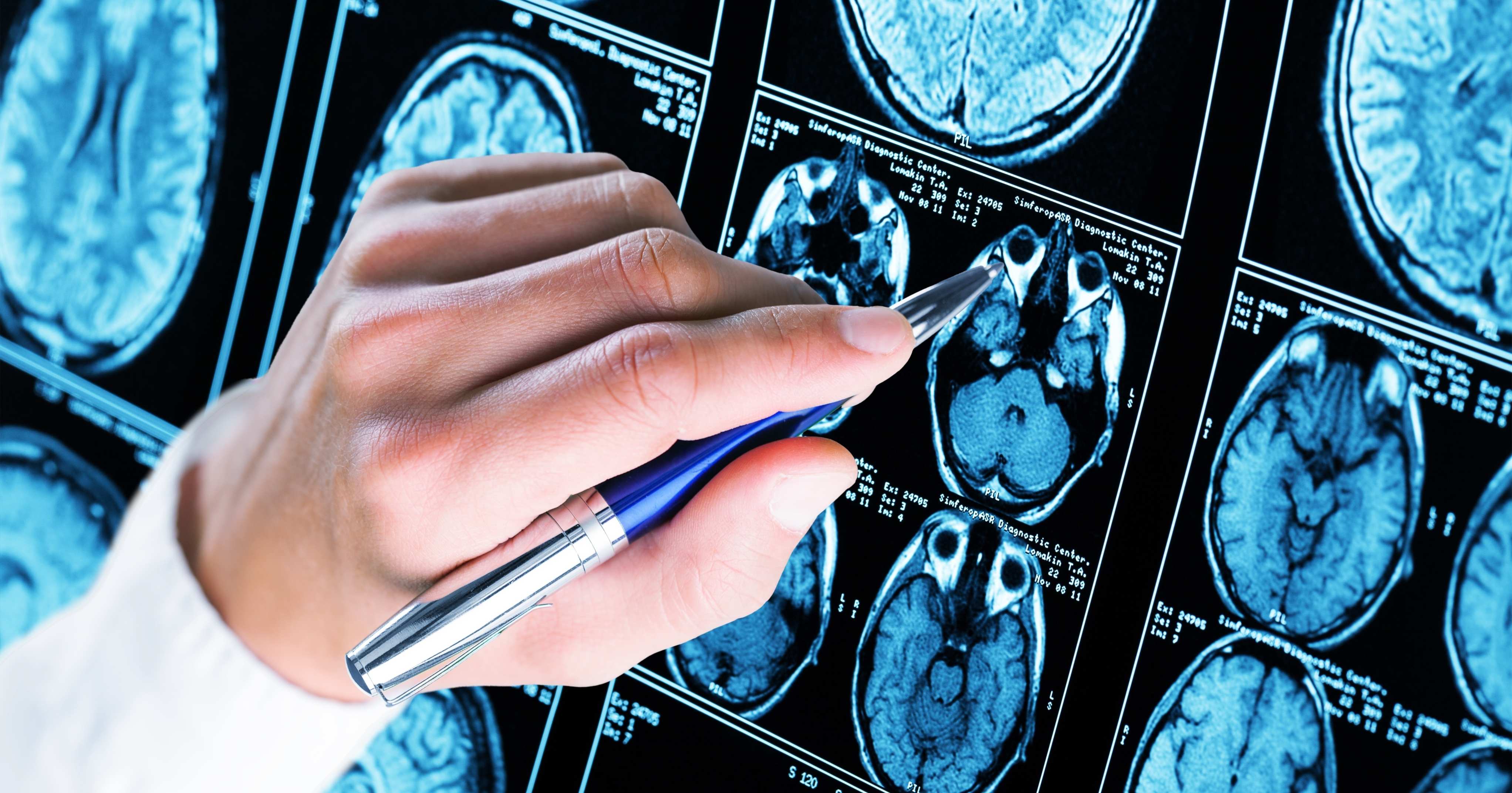 studio di una radiografia cerebrale