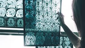 studio di esami cerebrali