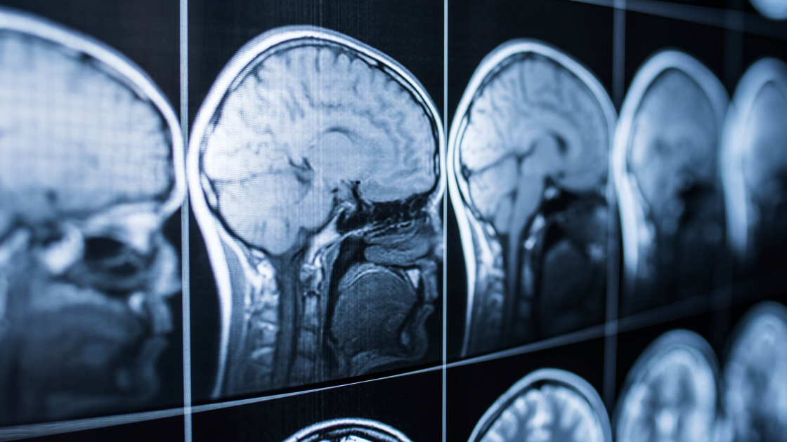 Medico psicólogo Medico psicólogo