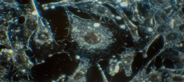 Funghi nei tessuti tumorali: una dinamica ecologica