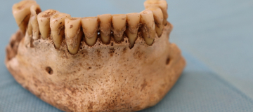 Nel microbiota orale delle popolazioni antiche le tracce della transizione verso l’agricoltura