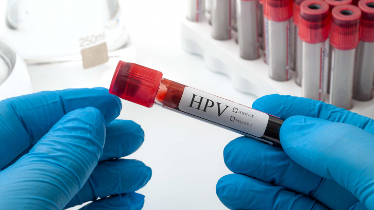 Papilloma virus Papilloma virus
