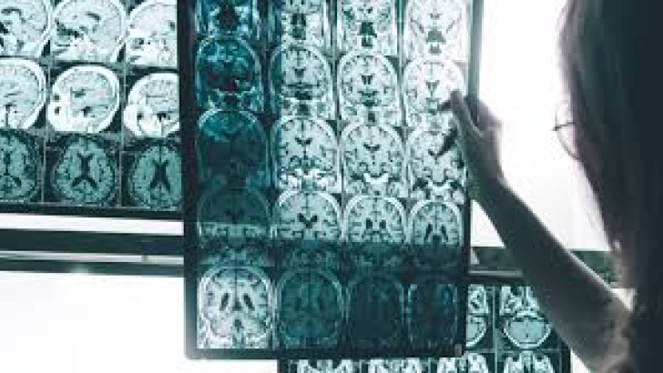 studio di esami cerebrali