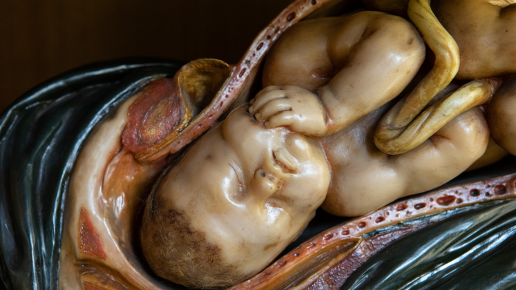 Modello in cera conservato alla clinica ginecologica ostetrica di Padova: gravidanza a termine, presentazione cefalica